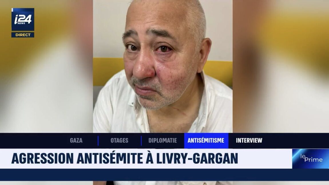 Read more about the article Jewish Man Beaten in Broad Daylight Near Paris Synagogue
